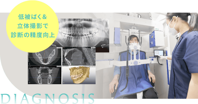 低被ばく・立体撮影で診断の精度向上
